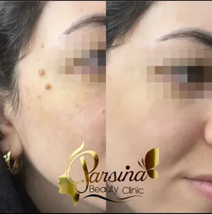کلینیک زیبایی پارسینا 4