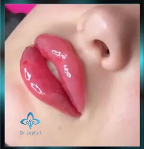 کلینیک پوست مو زیبایی دکتر سیفوری 5