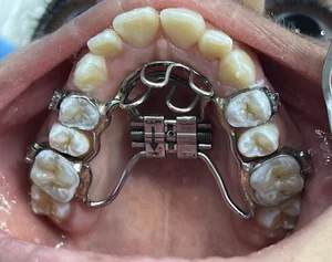 لابراتوار تخصصی ارتودنسی حبیبی (سازنده تخصصی اورال اپلاینس یا دستگاه دهانی خروپف)