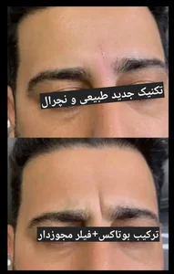 دکتر فروغ نجفی مرکز لیزر و زیبایی