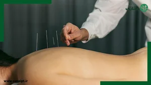 طب سوزنی بنکدار