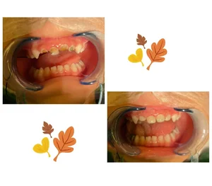 دکتر هدیه دانشور متخصص دندانپزشکی کودکان 4