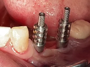 دندانپزشکی دکتر فتح اله عباسپور 3