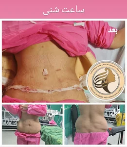 مطب دکتر سامان اکبری متخصص جراحی عمومی زیبایی