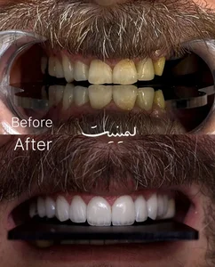 کلینیک دندانپزشکی مانا دنت ایمپلنت 5