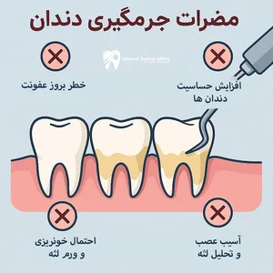 عوارض جرمگیری دندان چیست |‌ آیا جرم گیری دندان را خراب میکند؟