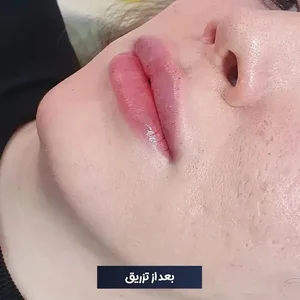 مرکز زیبایی دکتر طرزی 3