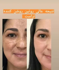 محصولات مراقبت از پوست و مو زرقانه 2
