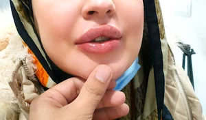 کلینیک زیبائی دکتر فرشید کریمی