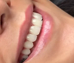 دندانپزشکی دکترشقایق جمالی 4