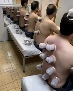 حجامت گلبرگ دکتر رضایی فر