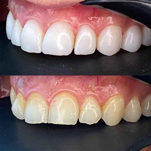 کلینیک دندانپزشکی و زیبایی دکتر فاطمه اسمی 5