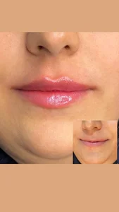 مرکز زیبایی ولیزر شقایق 4