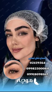 کلینیک زیبایی موچه 5