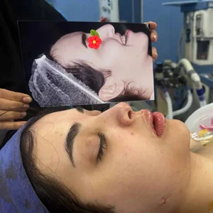 کلینیک زیبایی آندیا - کاشت ابرو ، بلفاروپلاستی و چشم گربه ای ، کاشت مو