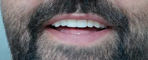 دندانسازی