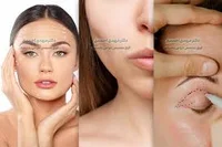 کلینیک زیبا لند24