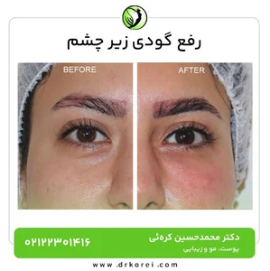 دکتر محمد حسین کره ئی | Dr.korei