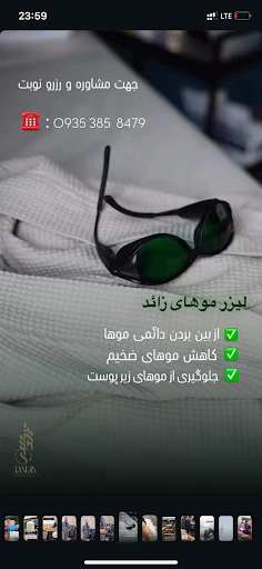 Lamore laser مرکز لیزر لامور