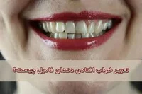 تعبیر خواب افتادن دندان و معنی دیدن دندان در خواب چیست؟