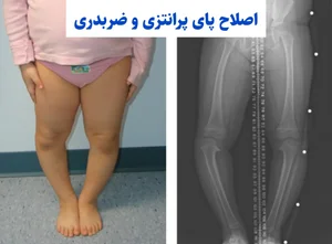 کلینیک توانبخشی و ارتوپدفنی کیاطب 4