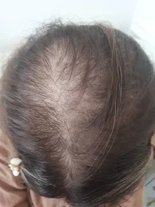 فیشیال و پاکسازی صورت مژگان 4
