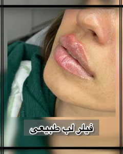 مطب دکتر نیما دهباشی 5