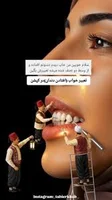 تعبیر خواب (افتادن دندان)...👇, دیدن دندان در خواب تعبیر به آشنایان و اقوام  میشود . دندانهای جلو تعبیر به اقوام نزدیک و دندانهای عقب دهان تعبیر به  اقوام دورتر می‌شود و چنانچه در خواب دندانی بیفتد ودر ...