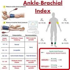 Ankle-Brachial Index (ABI) - Dr.StemCellsThailand's Anti-Aging and  Regenerative Medicine Center of Thailand