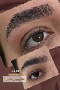اصلاح ابرو تخصصی هاشوری 2