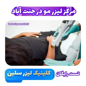 لیزر افرا