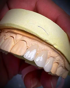 لابراتوار آیس دنت Icedent laboratory
