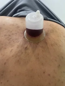 کلینیک لیزر و طب سنتی توک 3