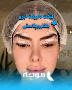 کلینیک زیبایی موچه 4
