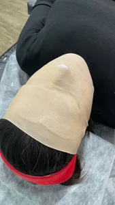 خدمات تخصصی پاکسازی پوست عسل 3