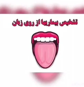 طب زبانشناسی حمزه پور 2