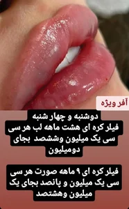 مرکز لیزر و زیبایی دکتر یعقوب اصفهانی 4
