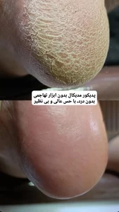 خدمات تخصصی ناخن سودابه ضربی 5
