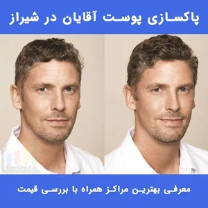 فیشیال و پاکسازی پوست نگارکاوه