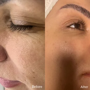 فیشال (مراقبت پوست) 2