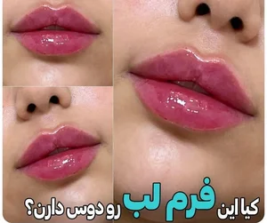 @Dr_laser_gorgan کلینیک لیزر و زیبایی نیوشا 2