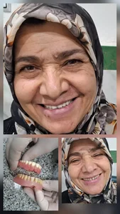 دندانسازی اَمین ملایی 4