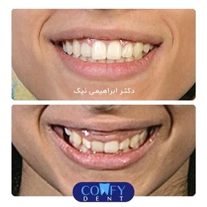 دکتر زهرا ابراهیمی نیک متخصص ارتودنسی و ناهنجاریهای فک و صورت