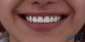 دندانپزشکی لایک دنتال 2