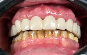 مطب دندانپزشکی دیجیتال دکتر مهدی جعفری 4