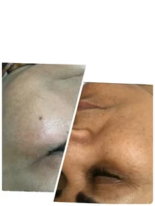 کلینیک پوست و مو درمیس