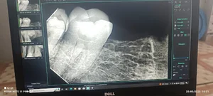 Nasri Denatl Clinic