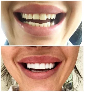 دکتر آرمین وکیلیان (جراح-دندانپزشک ایمپلنت و زیبایی)
