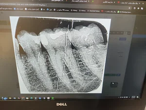 کلینیک دندانپزشکی آرش مهر