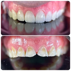 دندانپزشکی دکتر پدرام عبداله زاده 4